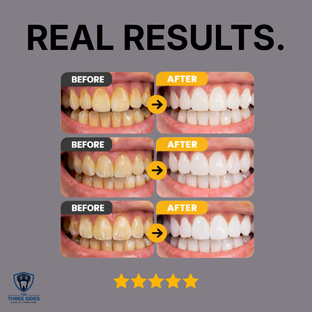 TriSmile Pro | The Three Sides