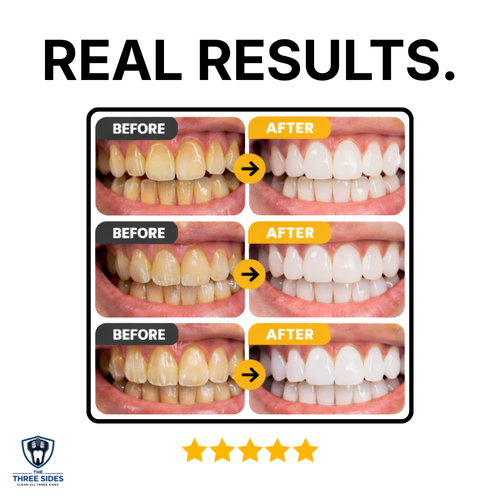 TriSmile Pro | The Three Sides